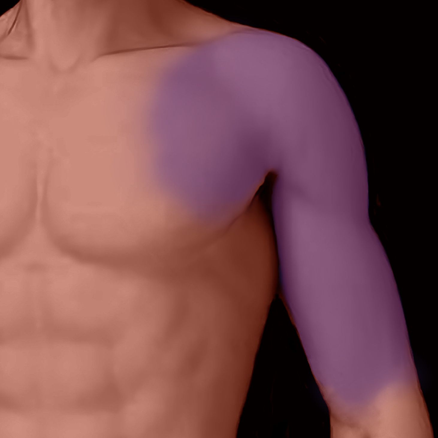 A person's upper body with the shoulder and arm highlighted in purple indicating Akebono Irezumi Mikiri