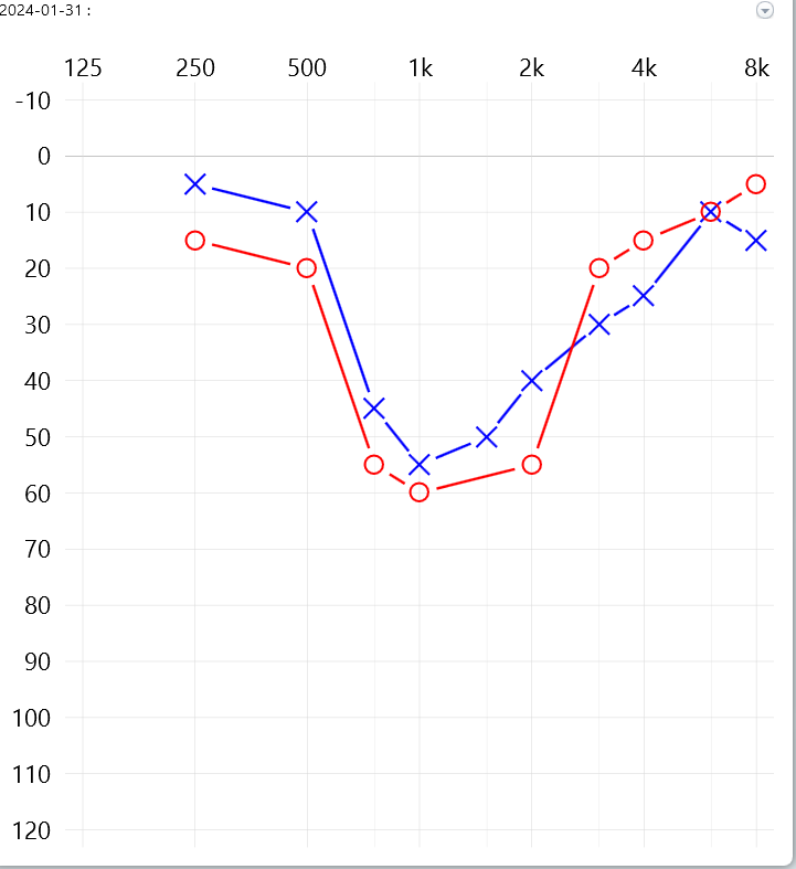 A graph of a person 's hearing is shown on a computer screen.