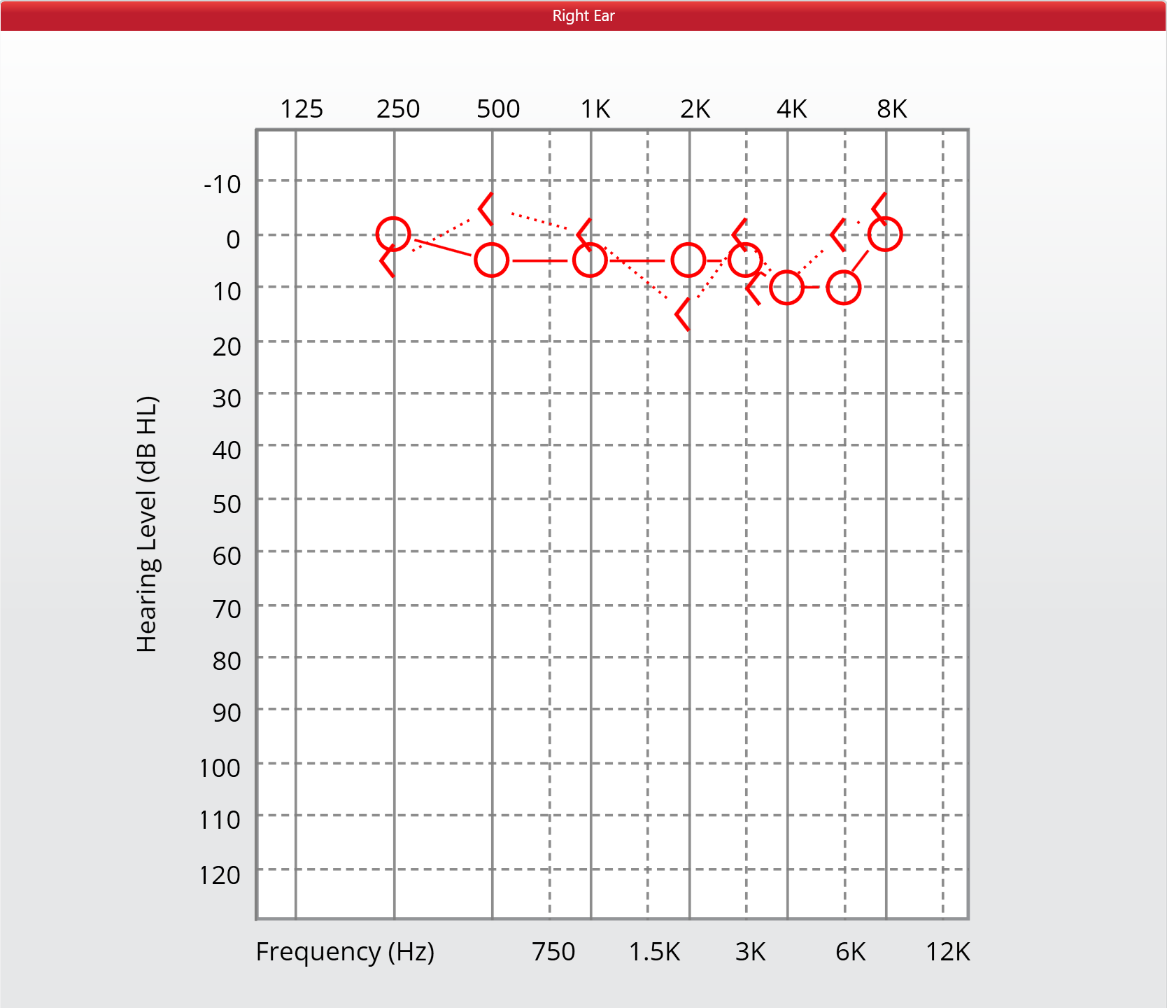 Audiogram showing mild hearing loss, with thresholds mostly within the normal range except for a slight dip at higher frequencies.