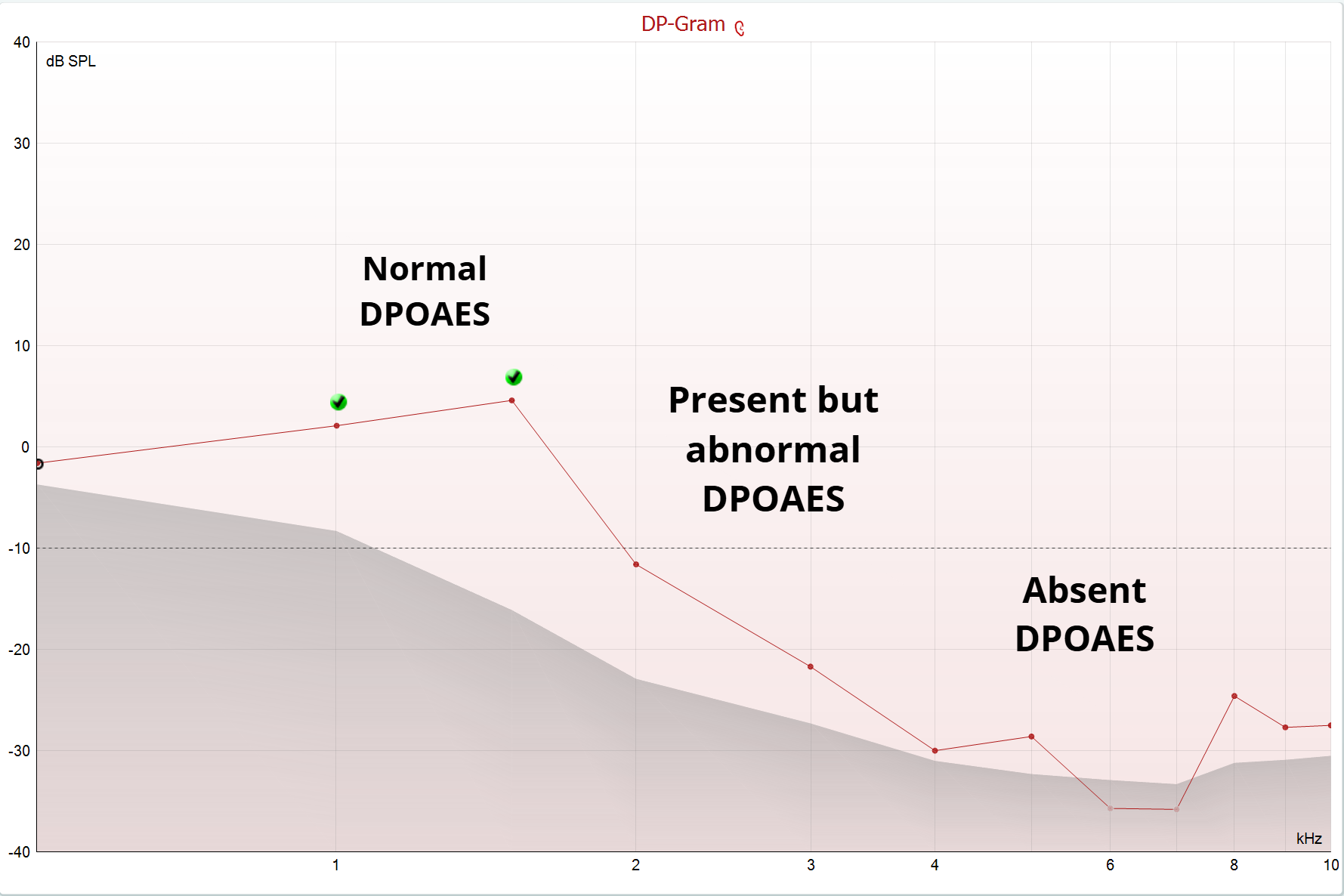 Graph showing DPOAES results: normal, present but abnormal, and absent responses across a frequency spectrum.
