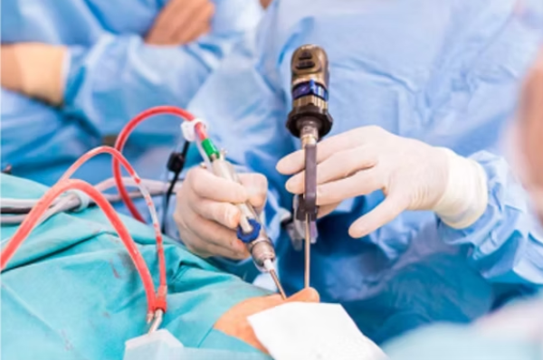 Otorrinolaringologista realizando cirurgia de correção do desvio de septo nasal.
