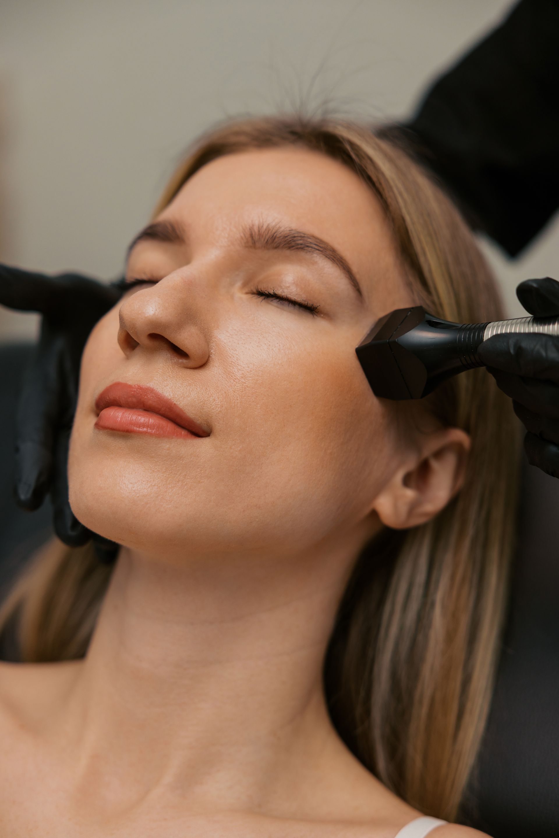 before & after forma facial