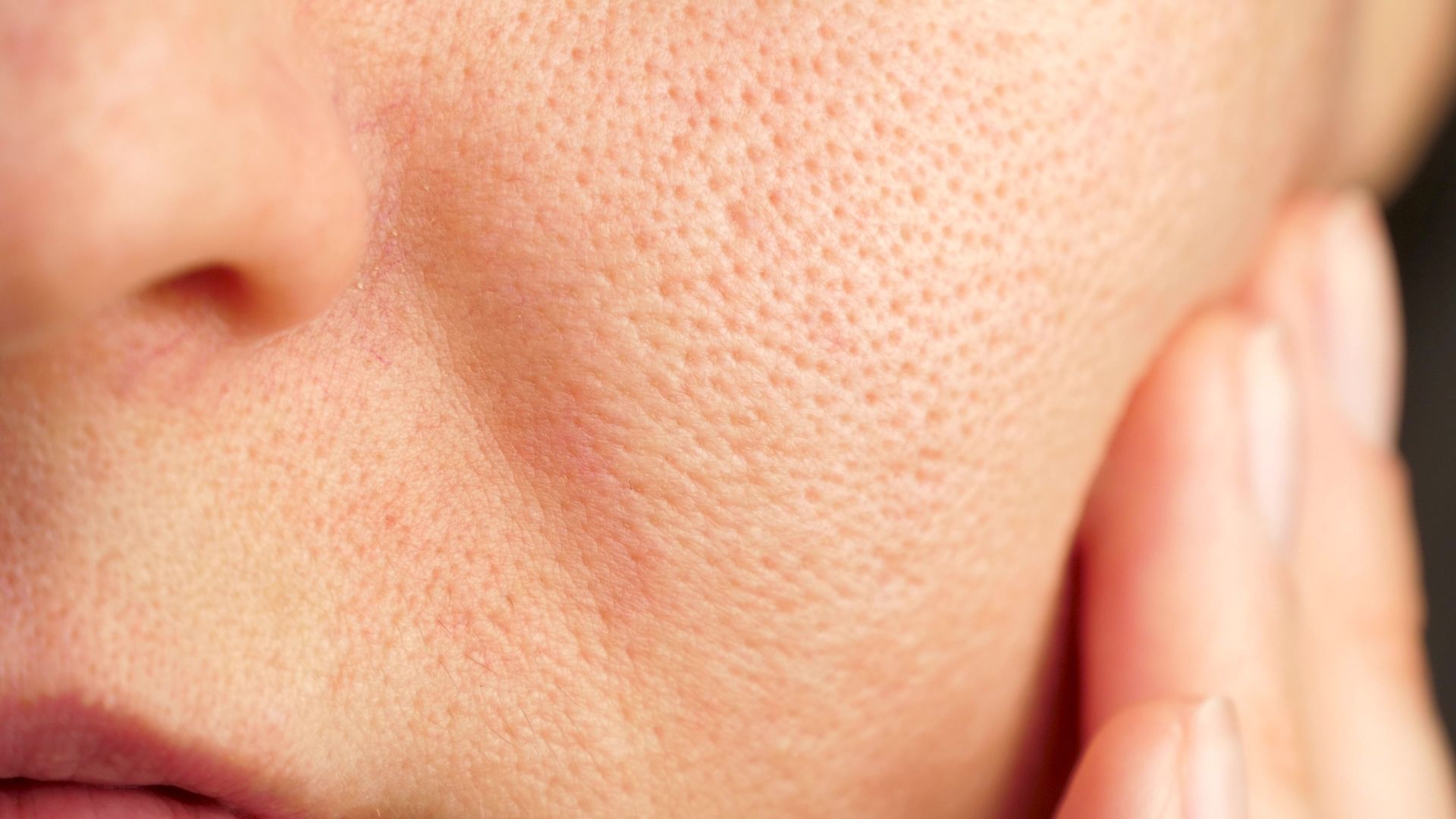 Close-up of a cheek with visible skin texture and a hand touching the face