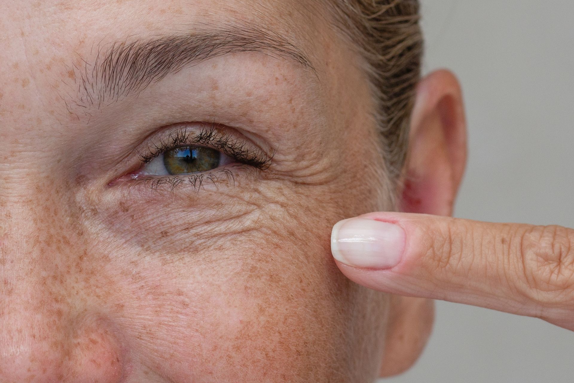 Close-up of a person pointing to under-eye wrinkles on their cheek