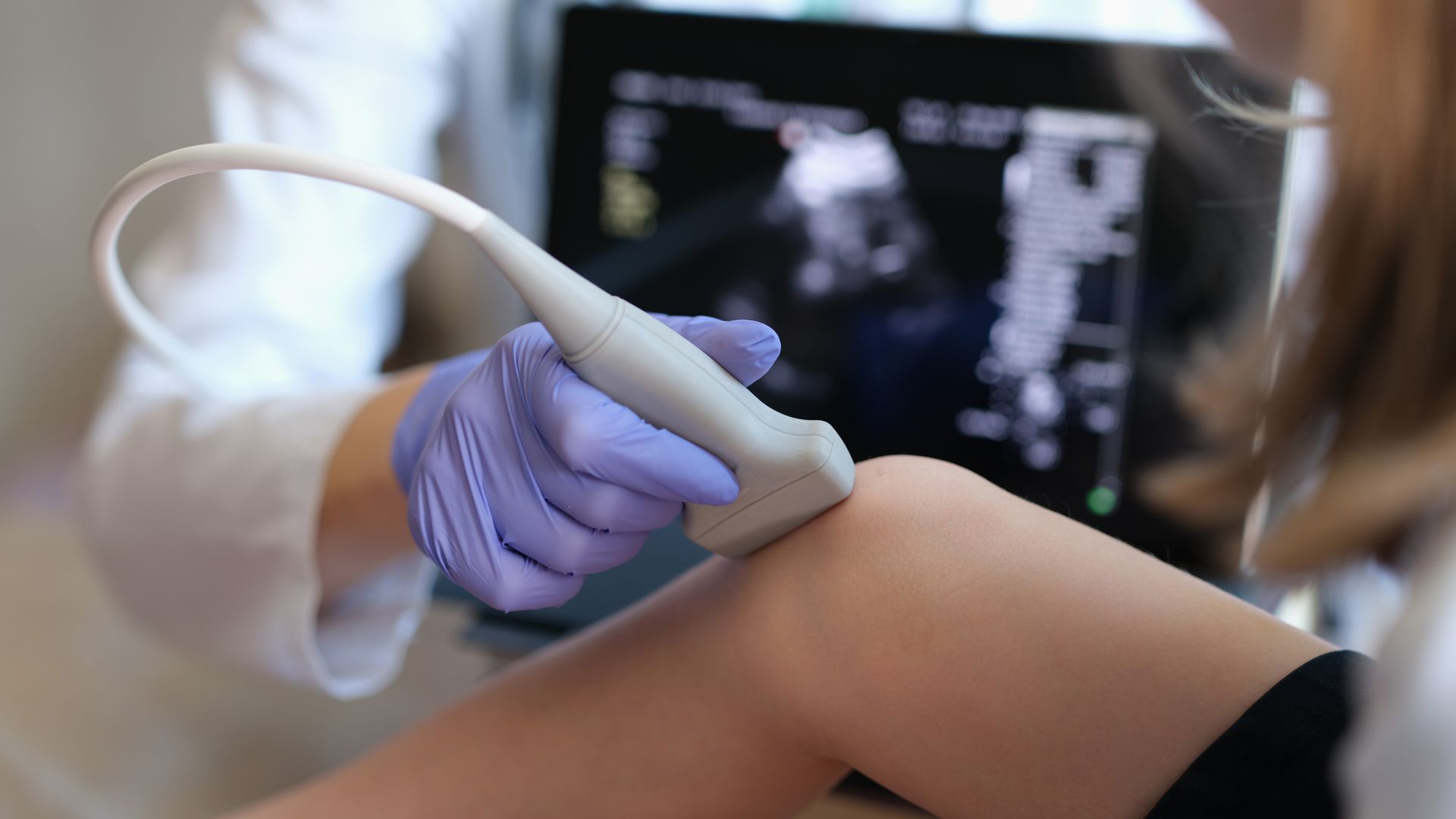 venous ultrasound on leg