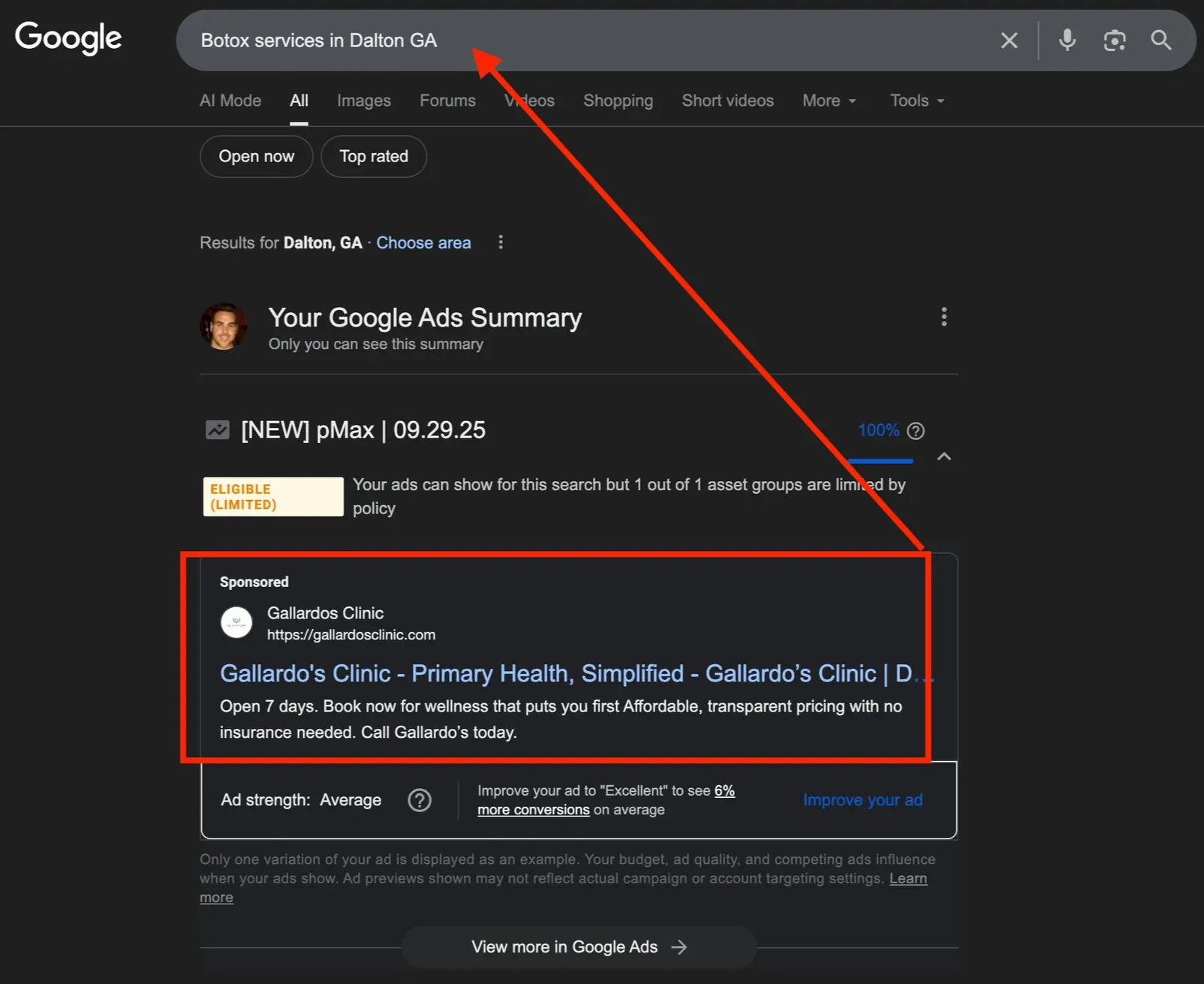 Botox search showing Gallardo's Clinic ranking on page one organically