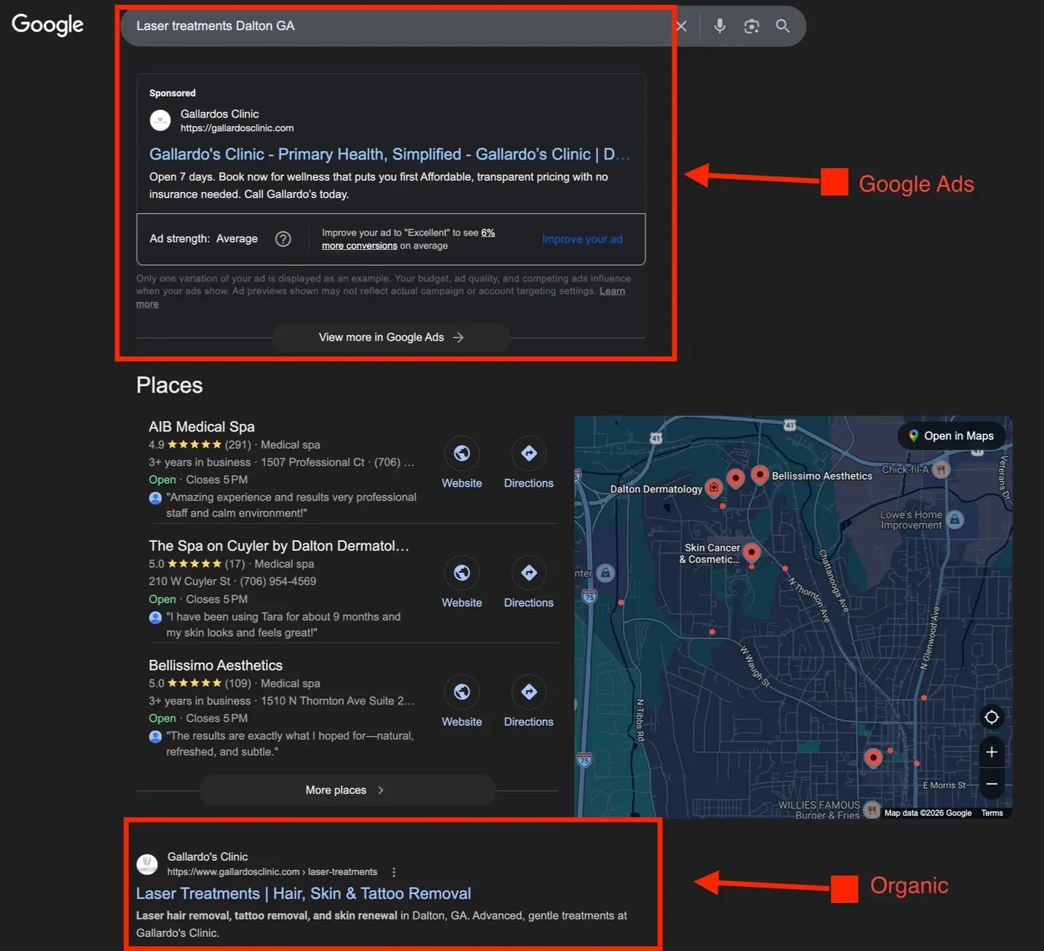 Laser services search showing Gallardo's Clinic on page one in both ads and organic results