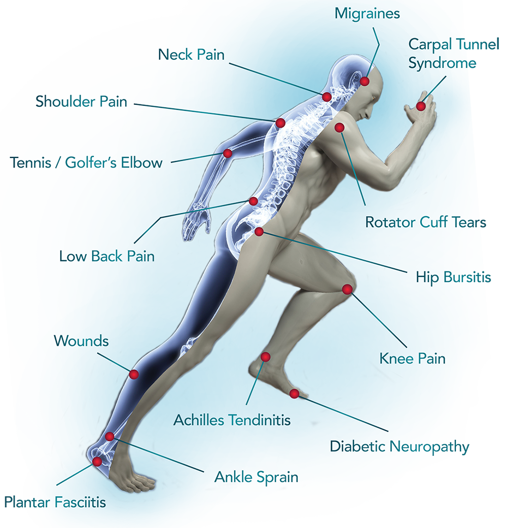 knee pain