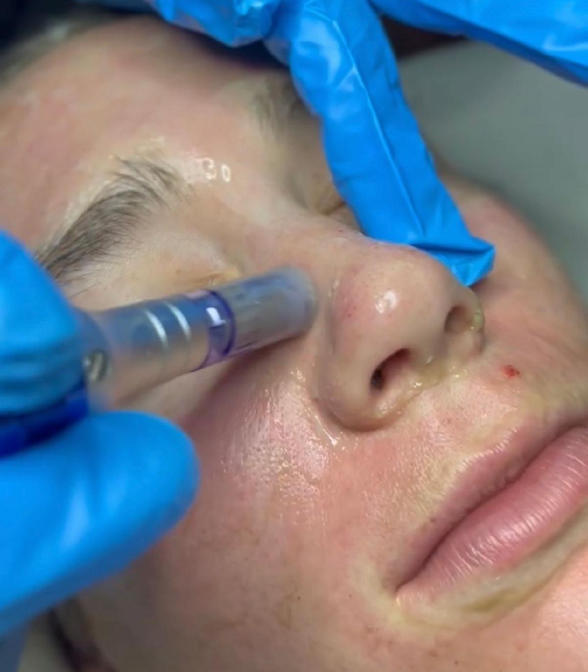 Health Spa Red bank, NJ Lotus Health & Aesthetics Spa