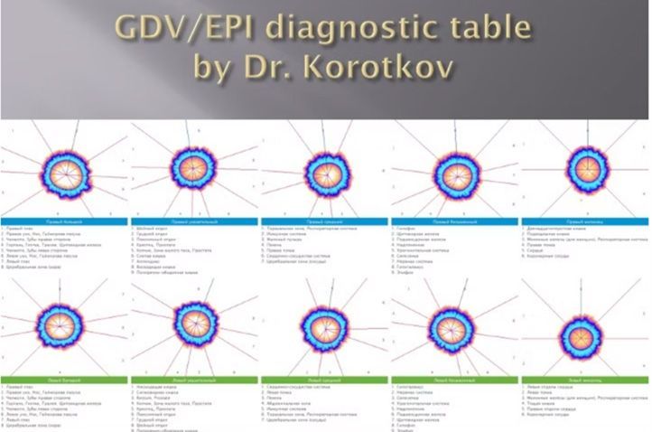 GDV/EPI diagnostic table by Dr. Korotkov with colored charts and comparison rows