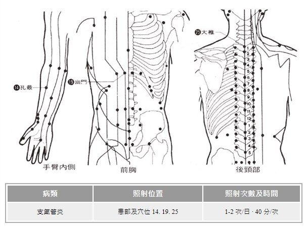 遠紅外線穴位療法