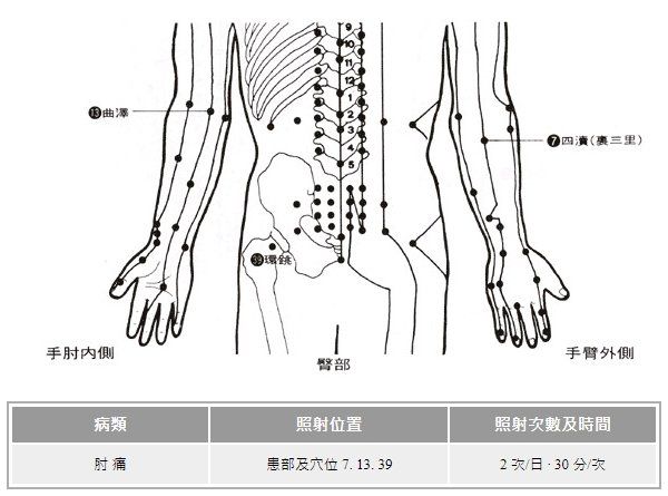 遠紅外線穴位療法
