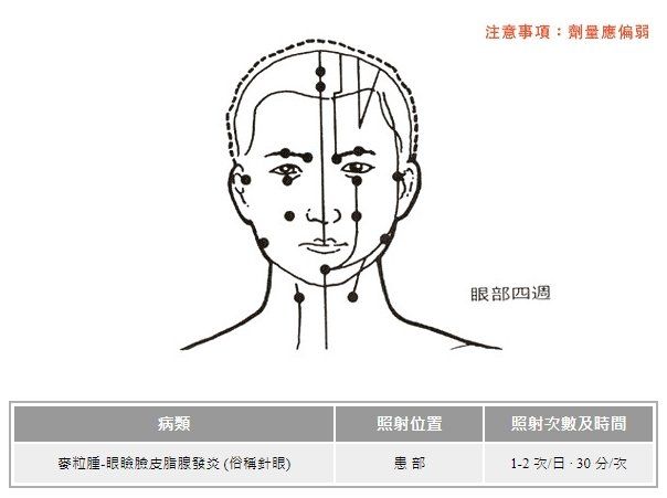 遠紅外線穴位療法