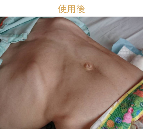 使用後 使用後