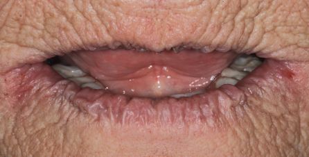 Close-up of a person's mouth with lips parted and tongue visible