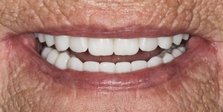 Close-up of a smiling mouth with bright white teeth and pink lips