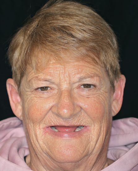 Smiling person with short light-brown hair, missing front teeth, wearing a pink hoodie on a dark background