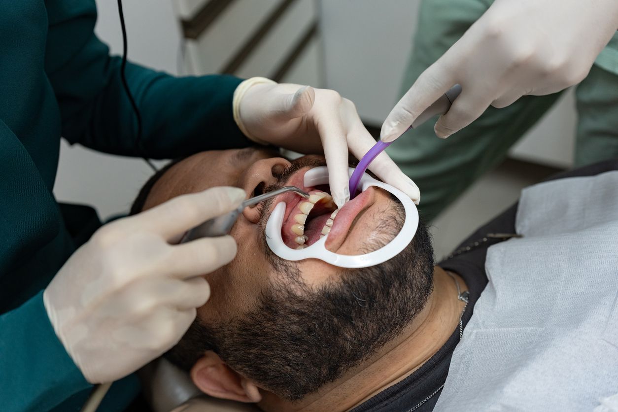 Dentist treating a patient’s mouth with gloved hands and dental tools during an exam