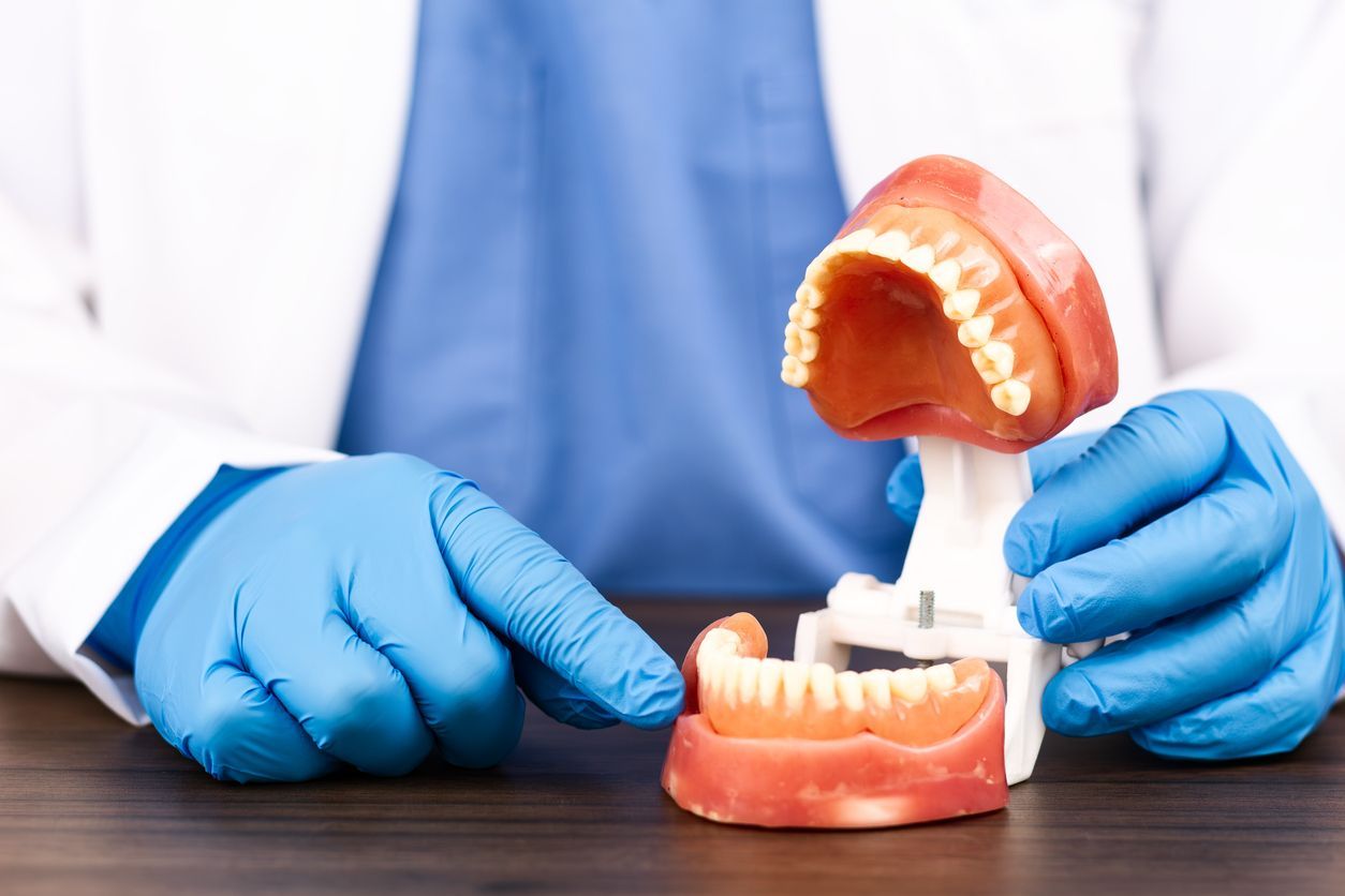 Gloved hands holding a dental model with open dentures on a table