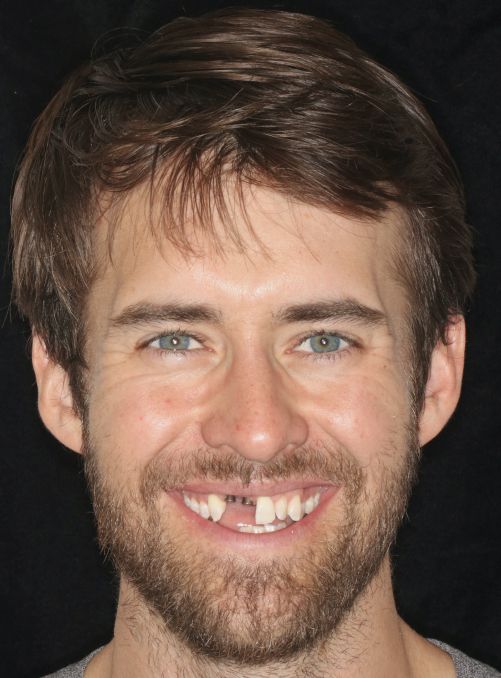 Smiling man with brown hair and beard against a dark background