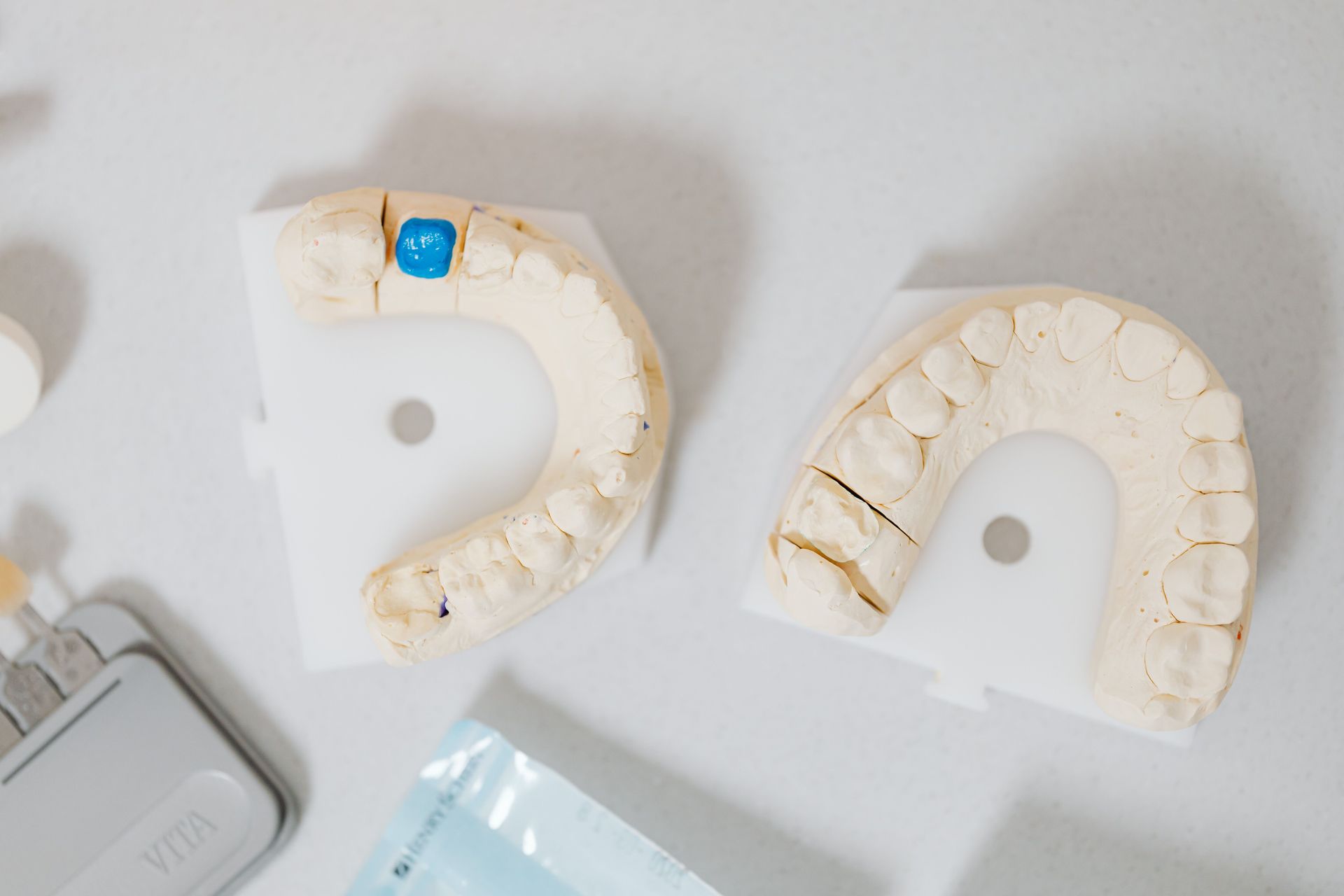 Dental crown and bridge models on a prosthodontist workbench in San Francisco, CA