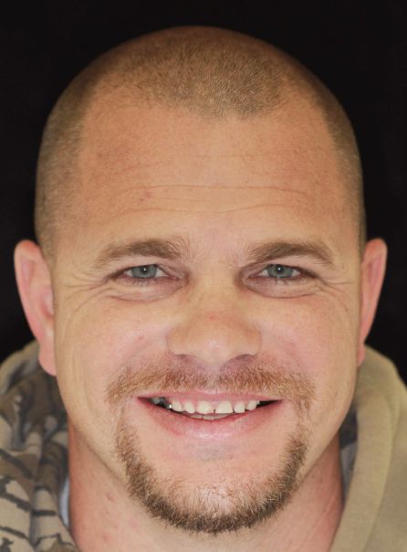 Close-up portrait of a smiling bald man with a short goatee against a dark background
