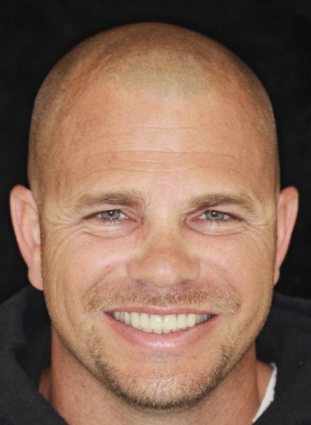 Smiling bald man with light beard against a dark background