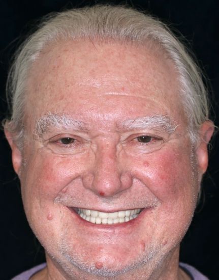 Smiling man with short white hair against a dark background