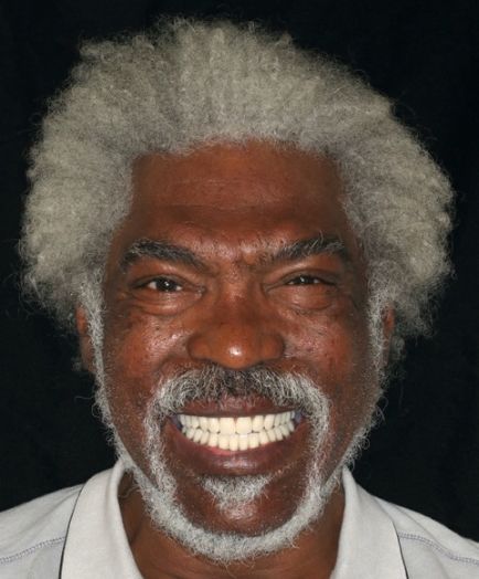 Smiling person with white hair and beard on a dark background, showing teeth.