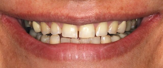 Close-up of a smiling mouth with visible teeth and lips