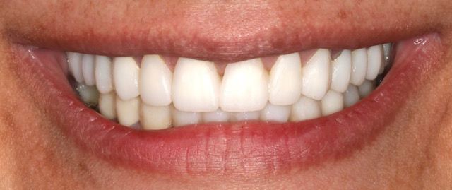 Close-up of a smiling mouth with white teeth and pink lips