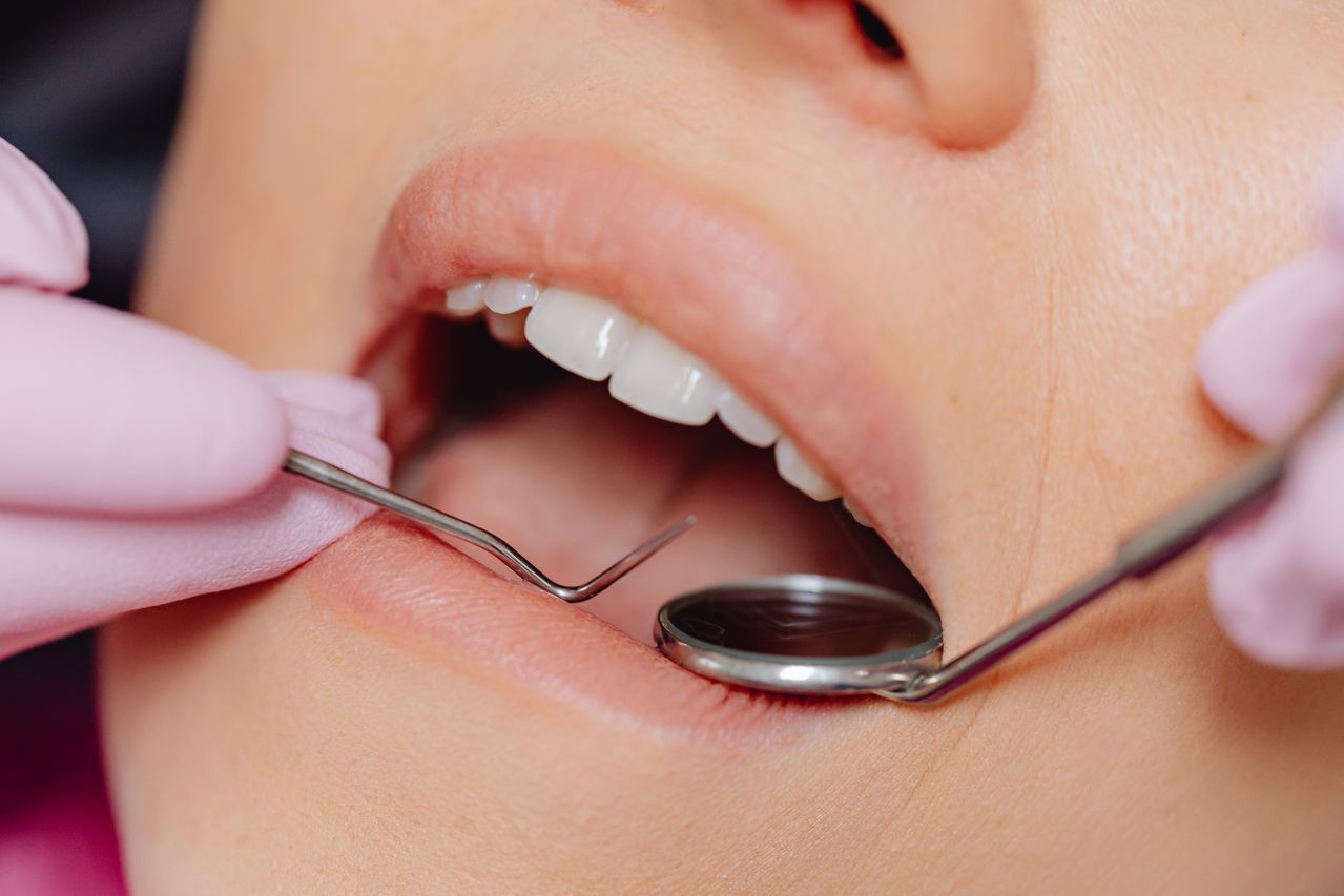 Dental Visit