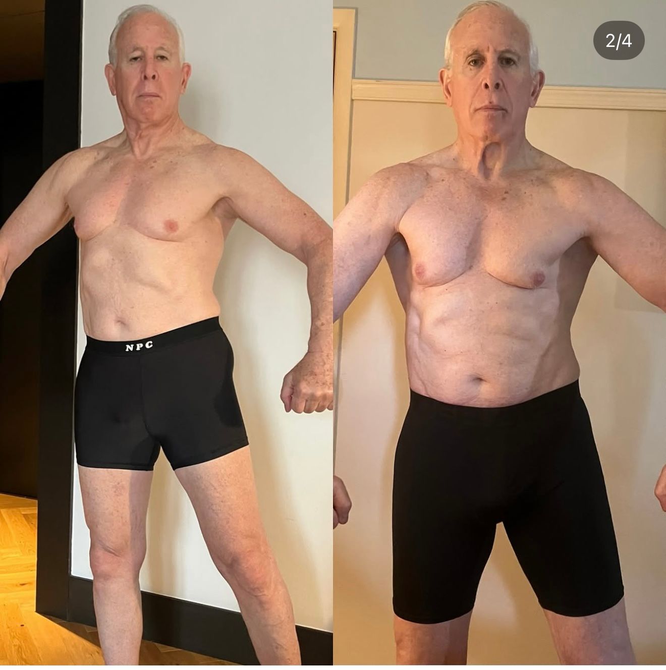 Before-and-after full-body comparison of a shirtless man in black shorts standing indoors.
