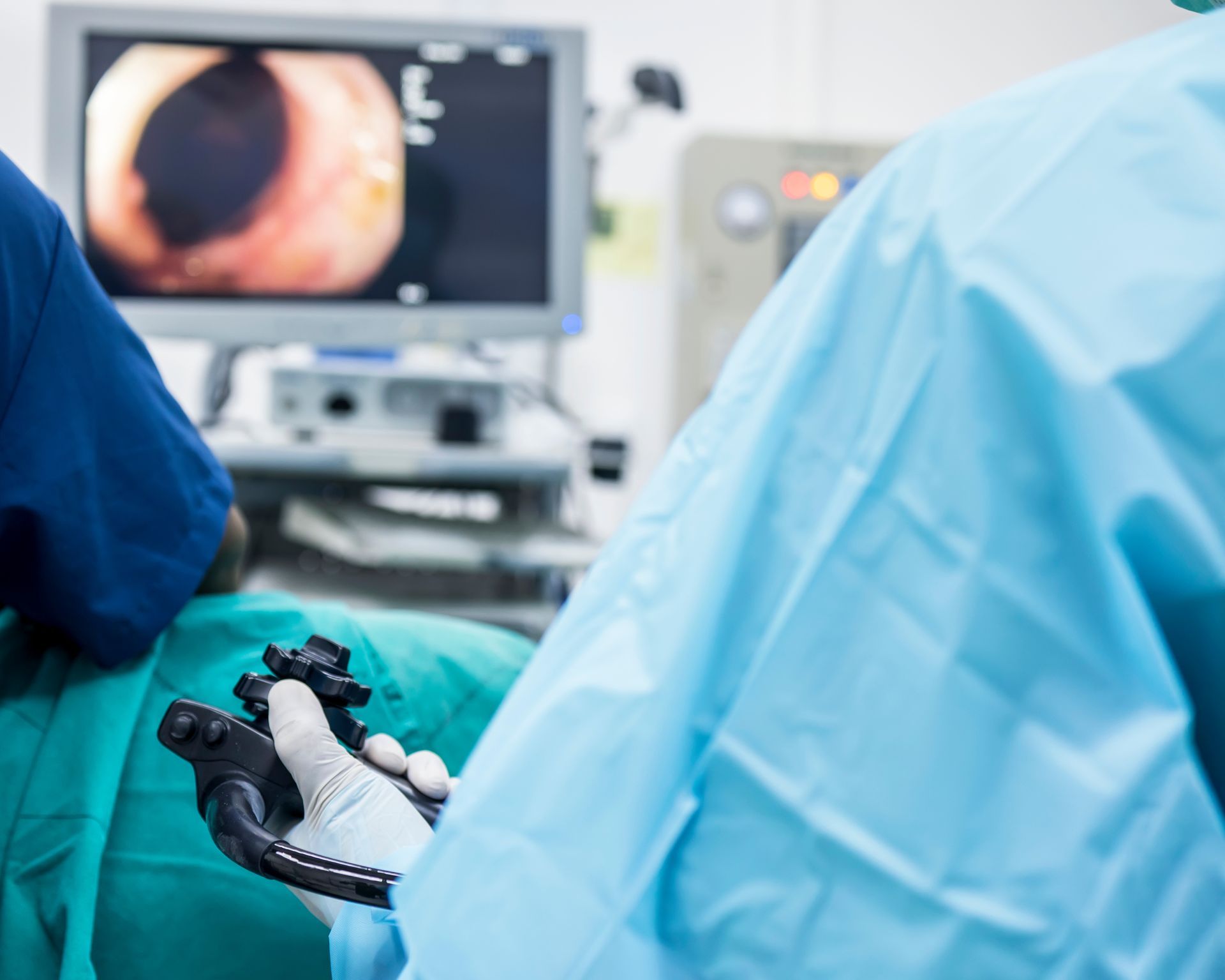 Colonoscopy Surgery