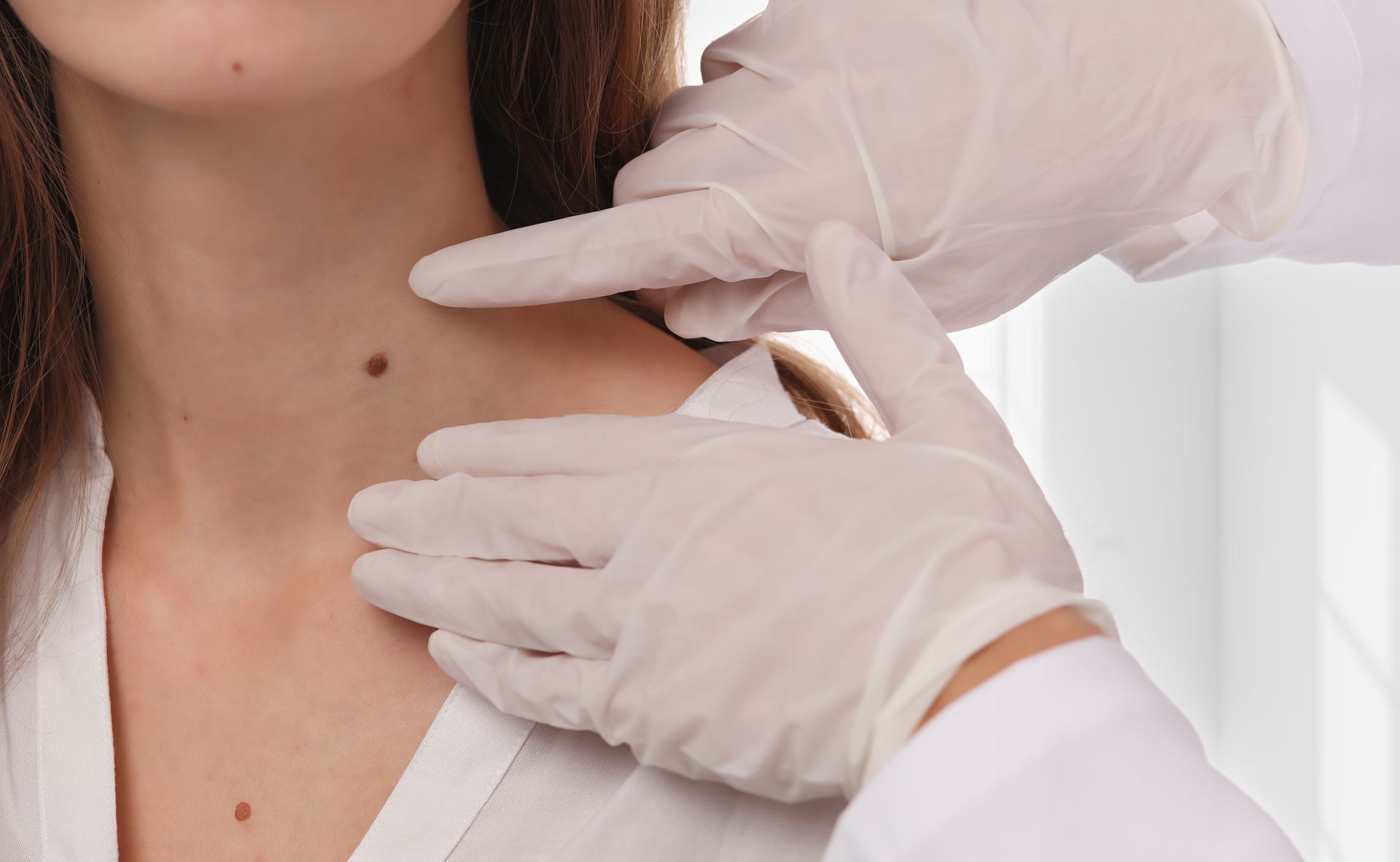 Removing Skin Tag Services