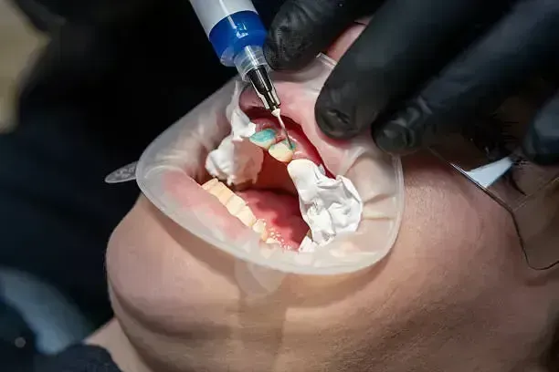 Dentist using a dental tool to treat a patient's open mouth