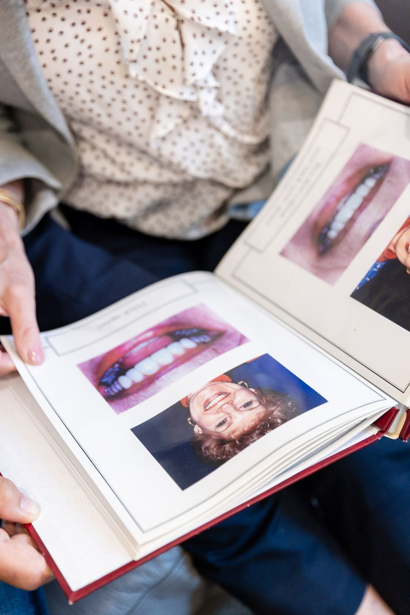 Person holding open book with close-up photos of a mouth and face on the pages
