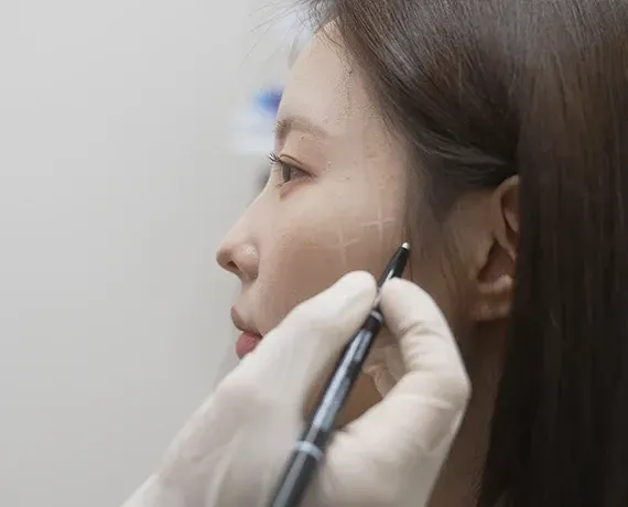 ONDA microwave lifting at Beautystone Clinic