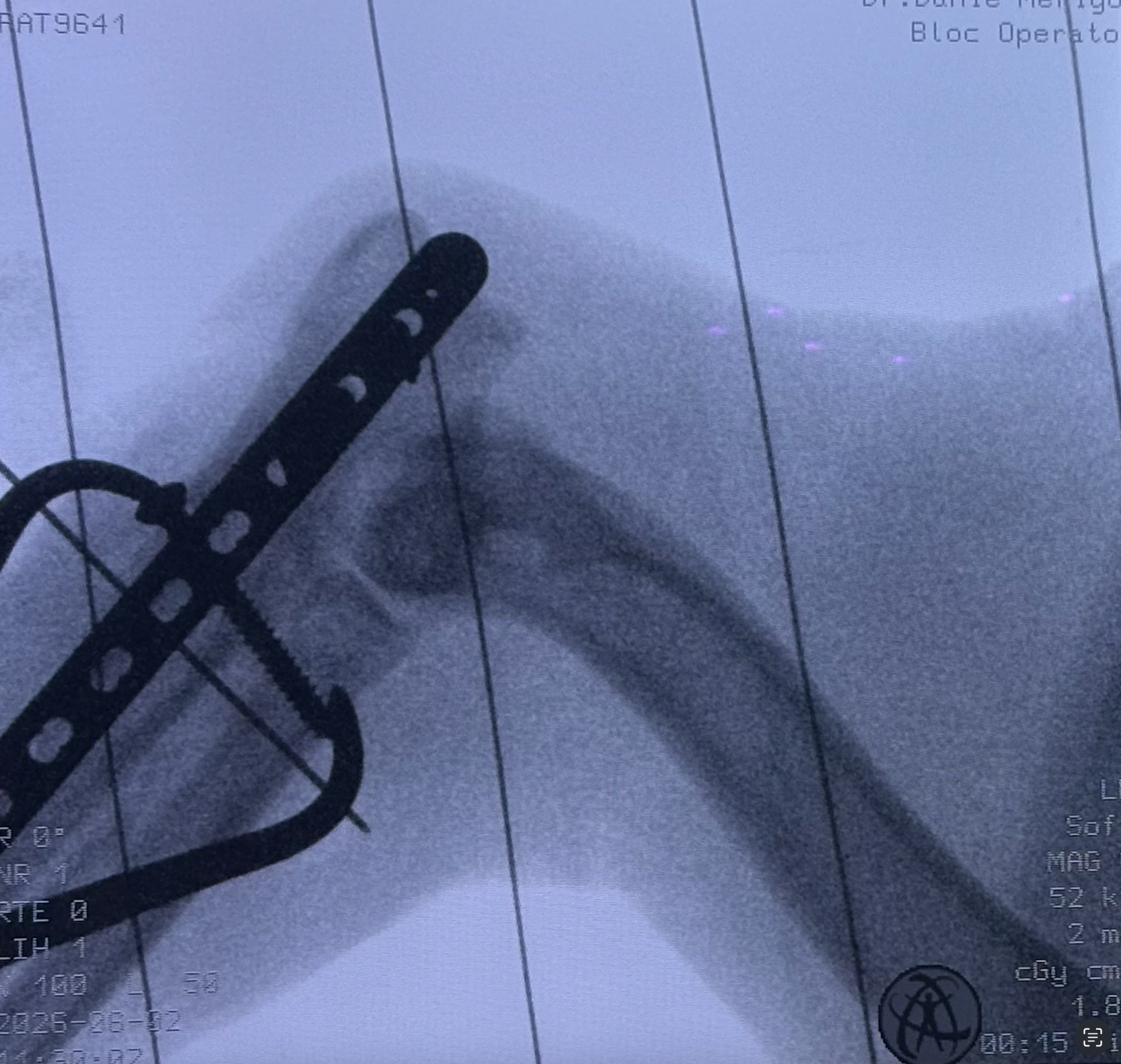Chirurgie interventionnelle 