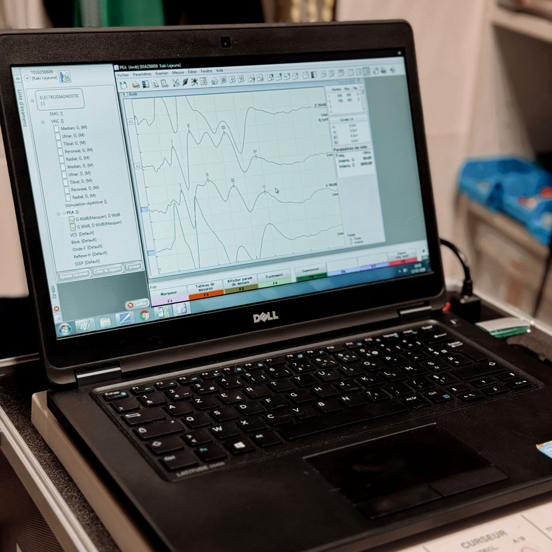 Un ordinateur portable Dell affichant un graphique linéaire est posé sur un bureau ; le clavier et le pavé tactile sont visibles.