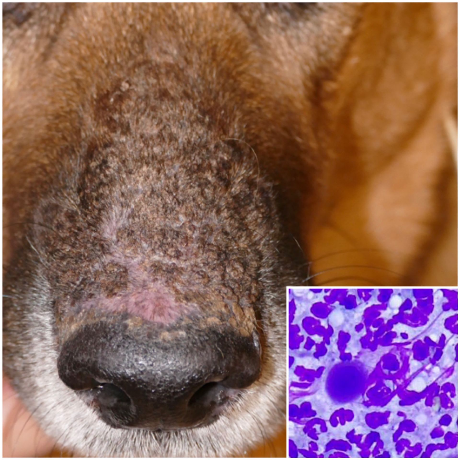 Pemphigus foliacé