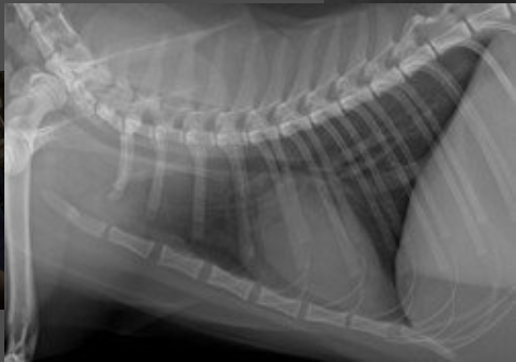 Radiographie numérique