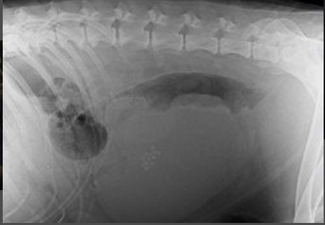Péraphie numérique abdominale.