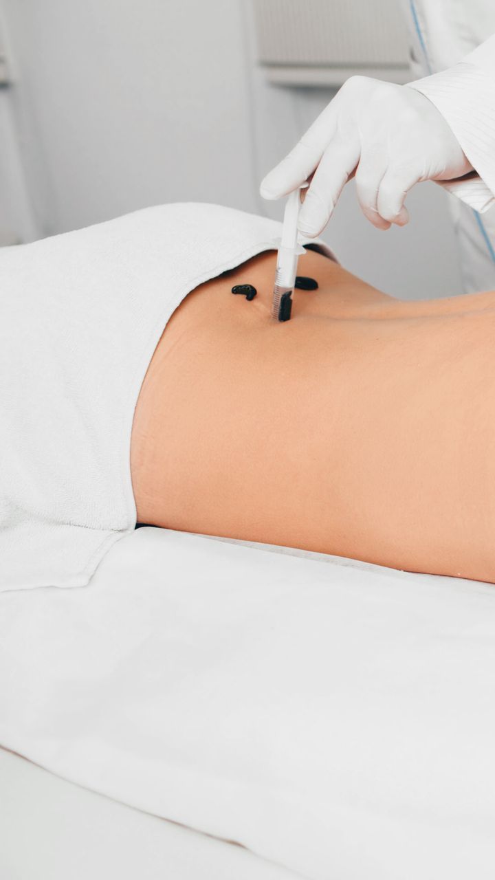 Una donna si sta sottoponendo a un trattamento anti-sanguisuga sullo stomaco.