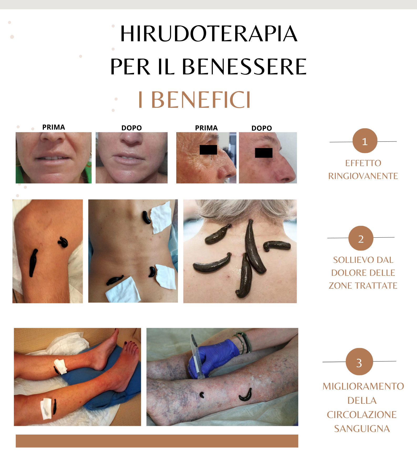A poster that says hirudoterapia per il benessere i benefici