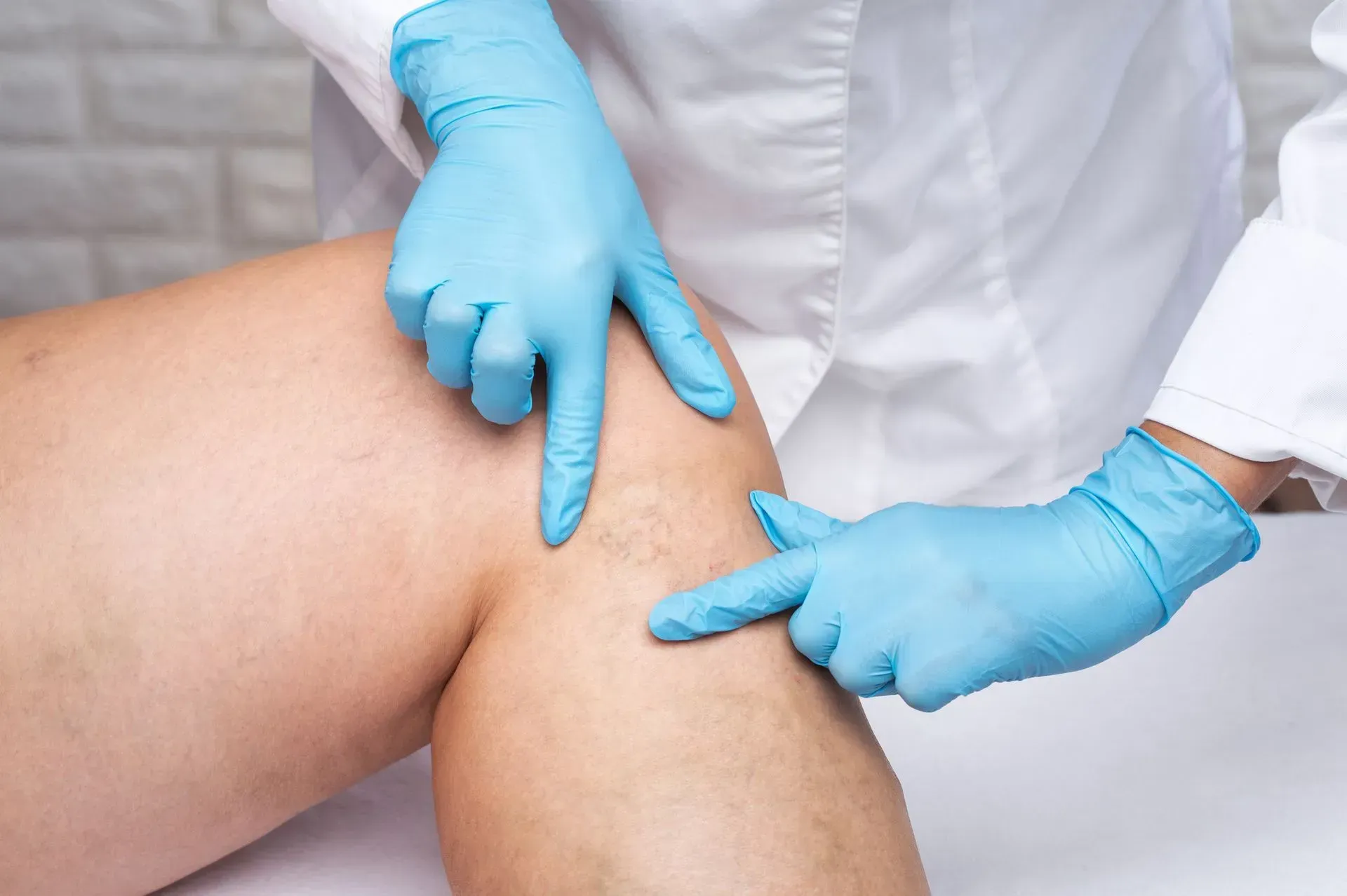 Healthcare worker in blue gloves examining a patient’s knee