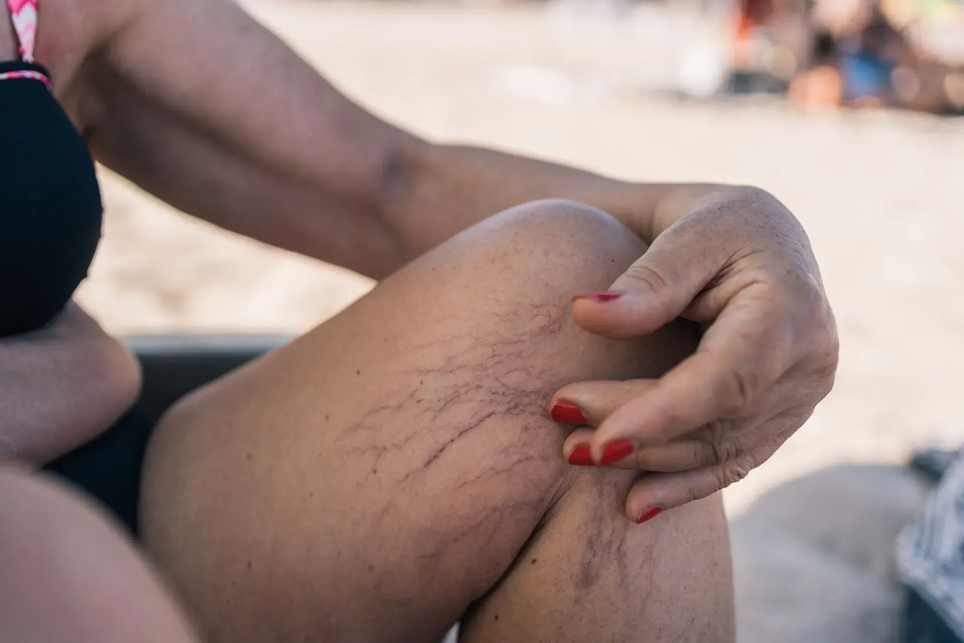 Hand scratching a bent knee on a sandy beach