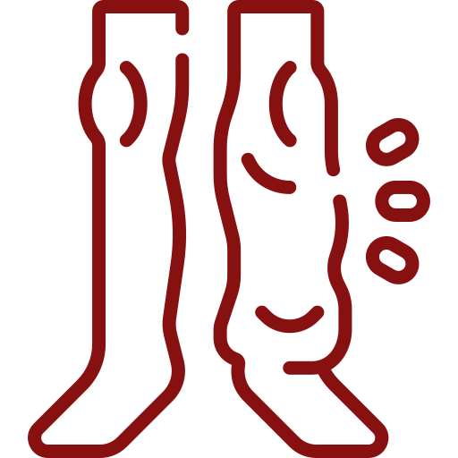 Red line icon of two lower legs and feet, with one leg injured and pain marks on the side