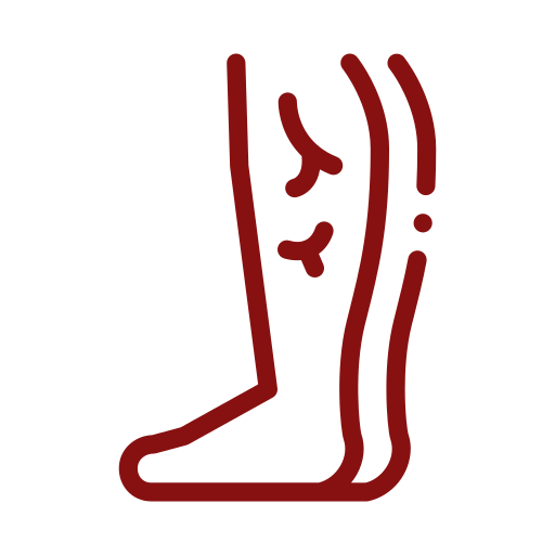 Red line icon of a lower leg with calf pain marks
