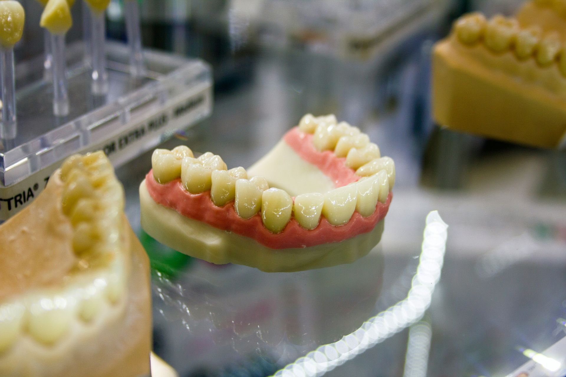 Model of upper teeth with pink gums and yellowish teeth, on display.